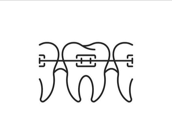 Orthodontics (Braces & Aligners)