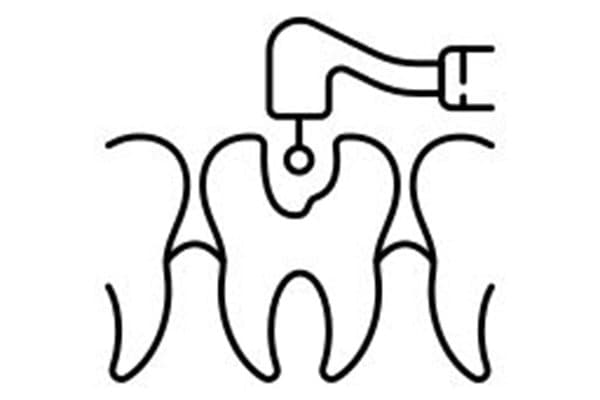 Dental Fillings
