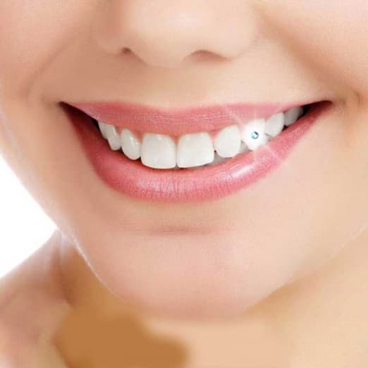 Tooth Jewelry