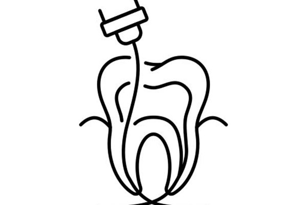 Root Canal Treatment